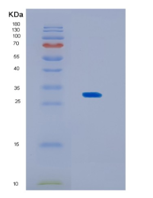 Recombinant Human KCTD15 Protein,Recombinant Human KCTD15 Protein