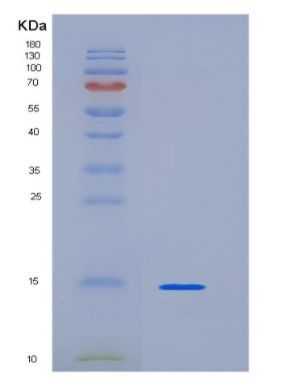 Recombinant Human KIAA0101 Protein,Recombinant Human KIAA0101 Protein