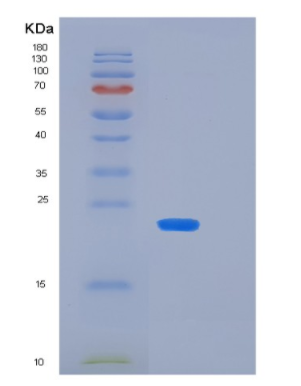 Recombinant Human KIR2DS4(p50 KIR Protein,Recombinant Human KIR2DS4(p50 KIR Protein