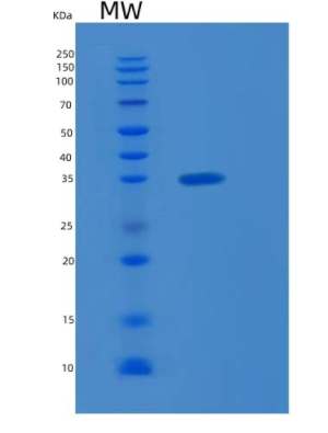 Recombinant Human KLF6 Protein,Recombinant Human KLF6 Protein