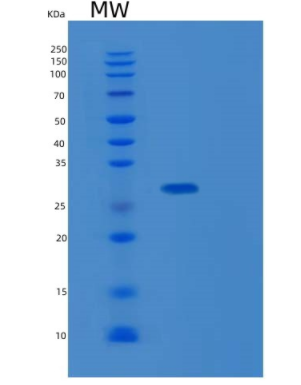 Recombinant Human KLK13 Protein,Recombinant Human KLK13 Protein