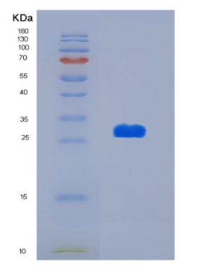 Recombinant Human KDSR Protein,Recombinant Human KDSR Protein