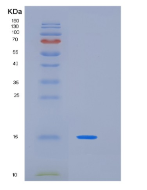 Recombinant Human KIR3DL1(Cytoplasmic tail Protein,Recombinant Human KIR3DL1(Cytoplasmic tail Protein