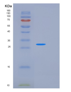 Recombinant Human KLK1 Protein,Recombinant Human KLK1 Protein