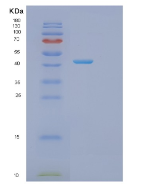 Recombinant Human ITPK1 Protein,Recombinant Human ITPK1 Protein