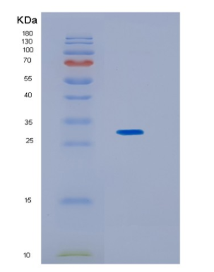 Recombinant Human KCTD5 Protein,Recombinant Human KCTD5 Protein