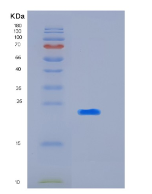 Recombinant Human KIR2DL3(p58 KIR Protein,Recombinant Human KIR2DL3(p58 KIR Protein