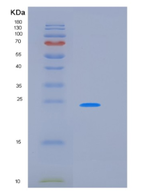 Recombinant Human KLK11 Protein,Recombinant Human KLK11 Protein