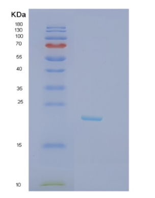 Recombinant Human JDP2 Protein,Recombinant Human JDP2 Protein