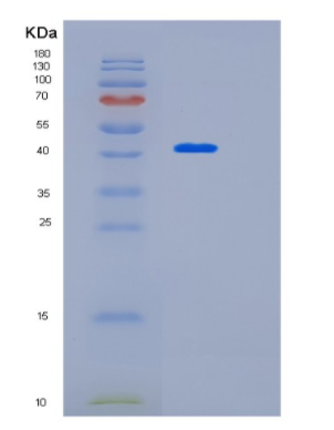 Recombinant Human KIAA0513 Protein,Recombinant Human KIAA0513 Protein