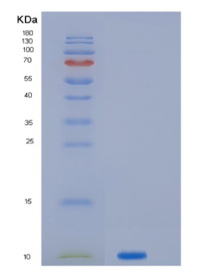 Recombinant Human JTB Protein,Recombinant Human JTB Protein