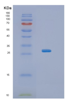 Recombinant Human KCTD11 Protein,Recombinant Human KCTD11 Protein