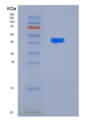 Recombinant Human KIN17 Protein,Recombinant Human KIN17 Protein