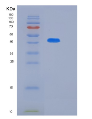 Recombinant Human KLF12 Protein,Recombinant Human KLF12 Protein