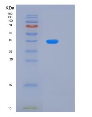 Recombinant Human KLHDC8B Protein,Recombinant Human KLHDC8B Protein