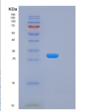 Recombinant Human KLK15 Protein,Recombinant Human KLK15 Protein