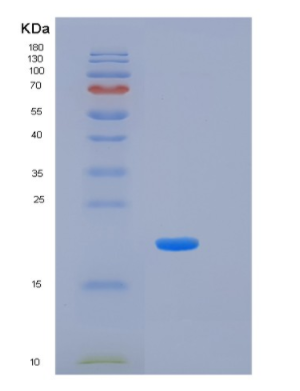 Recombinant Human KLK7 Protein,Recombinant Human KLK7 Protein