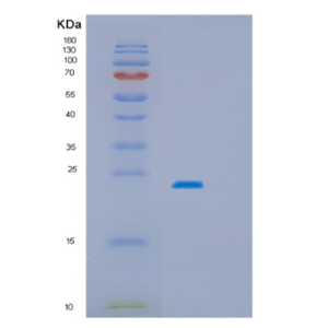 Recombinant Human HSPB2 Protein