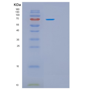 Recombinant Human HSPA9 Protein