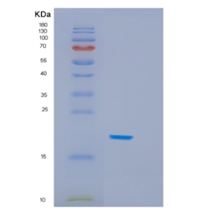 Recombinant Human HSPB6 Protein,Recombinant Human HSPB6 Protein