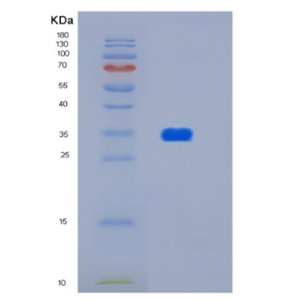 Recombinant Human HtrA2/Omi 134-458 Human Protein