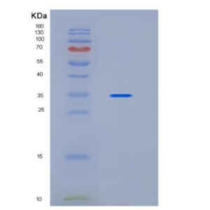 Recombinant Human IBSP Protein