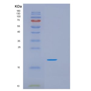 Recombinant Human HSPB7 Protein