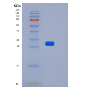 Recombinant Human HTATIP2 Protein,Recombinant Human HTATIP2 Protein