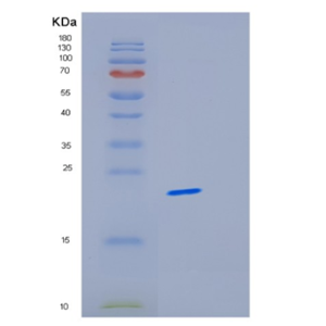 Recombinant Human ICT1 Protein,Recombinant Human ICT1 Protein