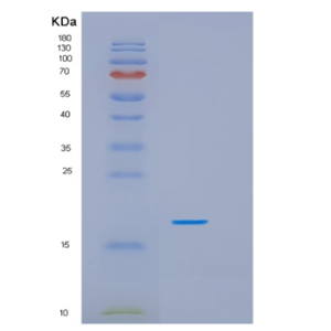 Recombinant Human HSPB9 Protein,Recombinant Human HSPB9 Protein