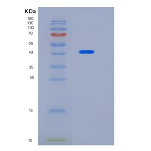 Recombinant Human HYKK Protein,Recombinant Human HYKK Protein