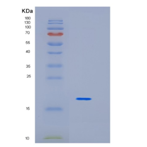 Recombinant Human ID1 Protein,Recombinant Human ID1 Protein