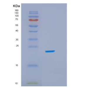 Recombinant E.coli idnk Protein,Recombinant E.coli idnk Protein