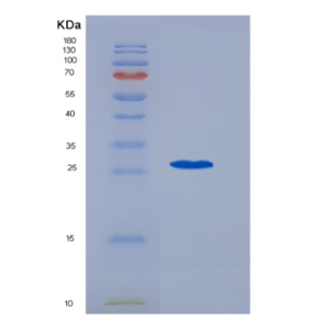 Recombinant Interleukin 6 (IL6)