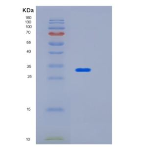 Recombinant Human HUS1 Protein