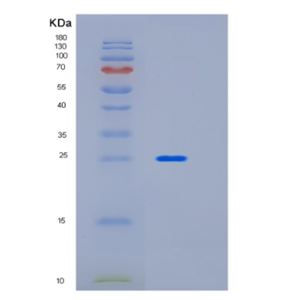 Recombinant Human ICAM2 Protein