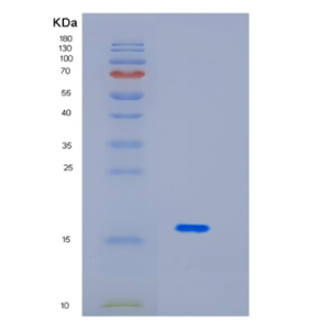 Recombinant Human ID2 Protein,Recombinant Human ID2 Protein