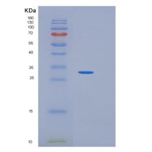 Recombinant Human IDI2 Protein,Recombinant Human IDI2 Protein