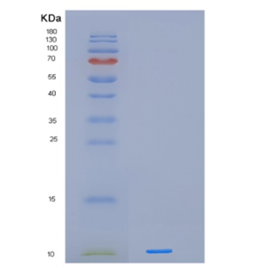 Recombinant Human IER3 Protein,Recombinant Human IER3 Protein