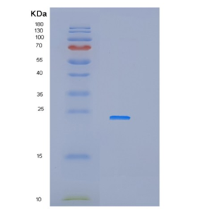 Recombinant Human IFNA14 Protein,Recombinant Human IFNA14 Protein