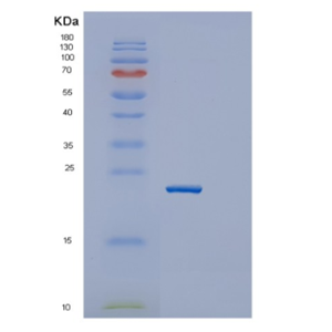 Recombinant Mouse Igfbp6 Protein,Recombinant Mouse Igfbp6 Protein