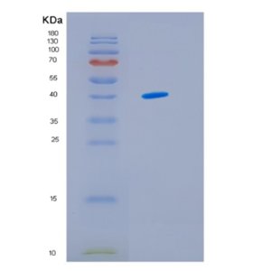 Recombinant Human IDH3G Protein