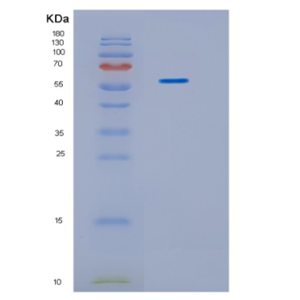 Recombinant Human IDS Protein