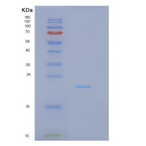 Recombinant Human IFNA7 Protein