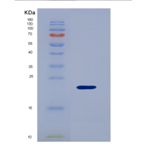 Recombinant Human IGFBP3 Protein,Recombinant Human IGFBP3 Protein