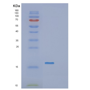 Recombinant Human IGJ Protein