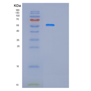 Recombinant Human IFIT3 Protein,Recombinant Human IFIT3 Protein