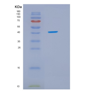 Recombinant Human IDO1 Protein