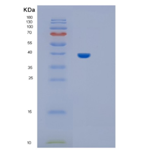 Recombinant Rat IL11ra1 Protein