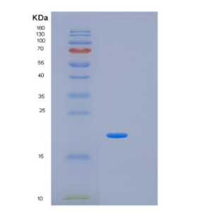 Recombinant Human IL17B Protein